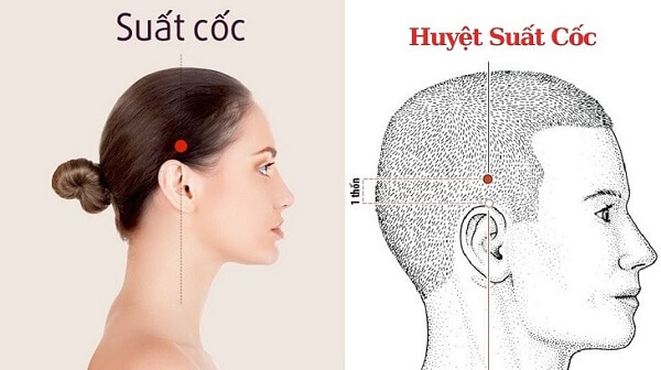 Nguyên nhân gây ra đau đầu thường gặp là gì ?